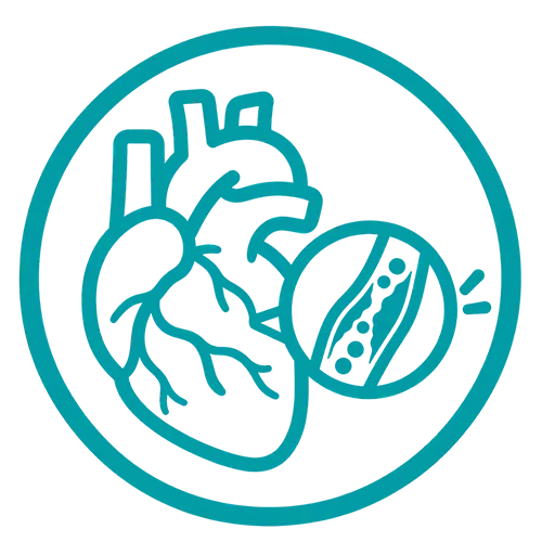 Coronary Artery Disease
