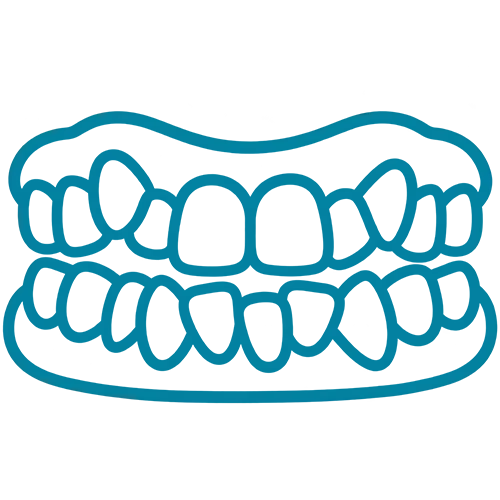 TMJ Disorders