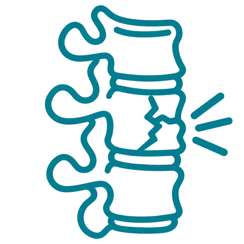 Spinal Fractures