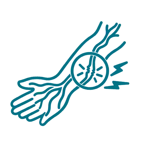 Peripheral Nerve Injury