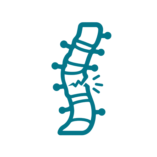Spinal Cord Injury