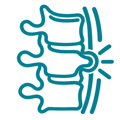 Spinal Disc Prolapse