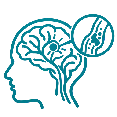 Cerebrovascular Disease