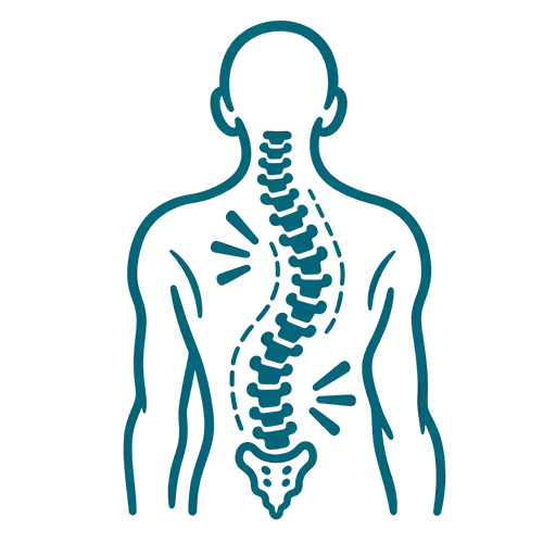 Scoliosis