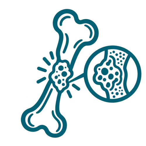 Bone Tumours