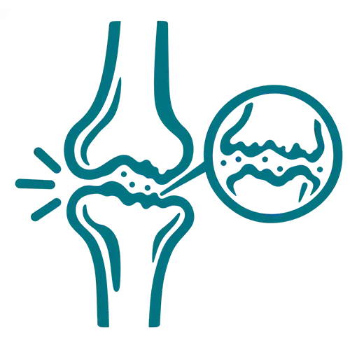 Osteoarthritis