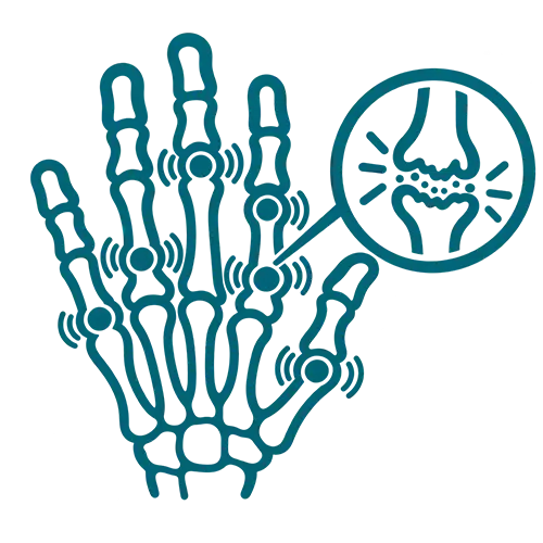 Rheumatoid Arthritis