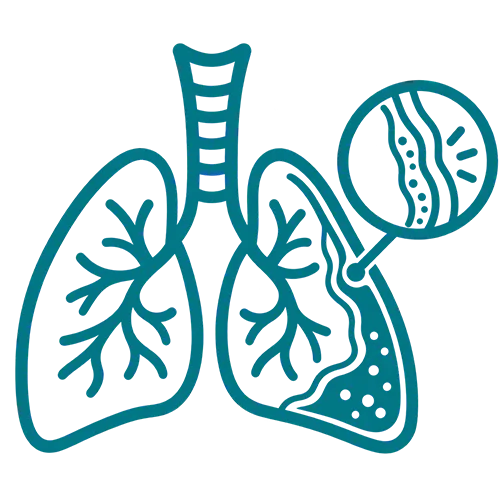 Pleural Disease
